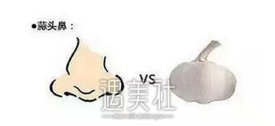 蒜头鼻整形前后对比