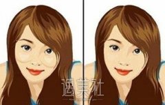 上海做磨颧骨大概多少钱呢?好像很多机构都没资质做呢? width=