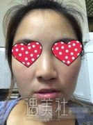 广州曙光医院调节疤痕果好吗?有真实案例吗想看看喃～ width=