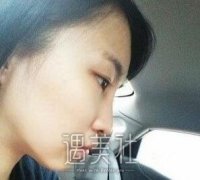西京医院整形科做了黑脸娃娃，傲娇甩掉“煤炭妹”称号～ width=