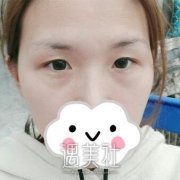 湛江华美整形美容医院做了双眼皮，给闺蜜也推荐来这儿! width=
