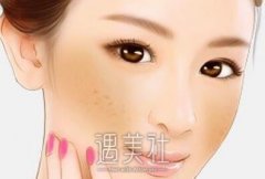 长沙激光调节黄褐斑需要多少钱?脸上很多斑真的烦! width=