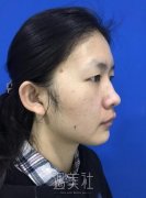 成都娇点马占军案例：马医生的技术真的很不错欸~ width=