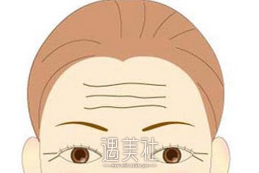 去除抬头纹