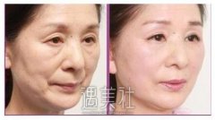 贵阳华美注射整形价格贵不贵，什么能影响价格? width=