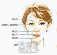 青岛伊维兰去皱多钱一针，几针有果? width=