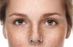 武汉c6激光祛斑多少钱，影响价格的因素是什么? width=