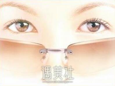 宁波,开外眼角