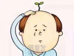长沙做植发手术大概需要多少钱?面积越大价格越贵吧? width=