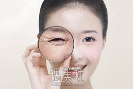 鱼尾纹