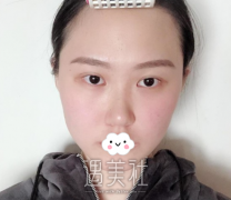 蒋亚楠鼻子怎么样，有没有什么案例借鉴 width=