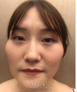 上海首尔丽格磨骨事件 土妹摇身一变明星脸 width=