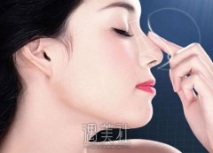 沈阳百嘉丽隆鼻多少钱？什么价位比较靠谱？ width=