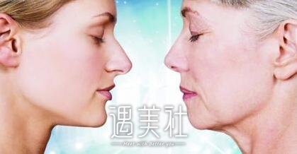 激光美容除皱