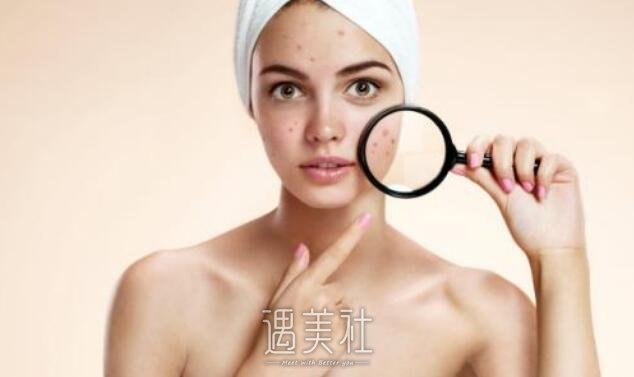 西安公立医院祛痘印多少钱，会不会比私立的贵?
