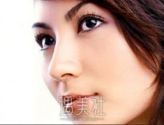苏州鼻翼缩小整形价格贵不贵，什么原因控制了价格？ width=