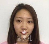 李青峰做鼻子的风格是怎样的呢?有没有案例喃? width=