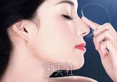 自体脂肪隆鼻