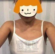 张立彬丰胸案例：张立彬“丰胸”小能手名不虚传呐～ width=