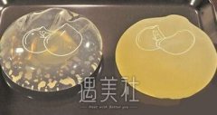 做妙桃丰胸果是不是立马就能看见，果有这么好? width=