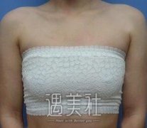 碧波庭丰胸案例：终于有了做女人的自信！ width=