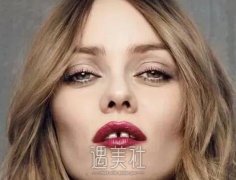 成年人牙齿缝隙大矫正方法是什么，牙齿矫正好不好？ width=