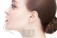 湘潭垫下巴整形的价格是多少，听说收费不统一~ width=