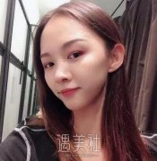 韦敏隆鼻案例：可以说360度无死角 width=