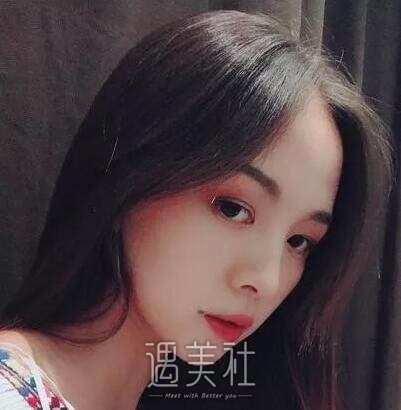 韦敏,隆鼻