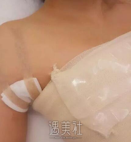 李德廷,丰胸