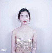 张立彬脂肪丰胸案例图 果真实不惧揉捏 width=