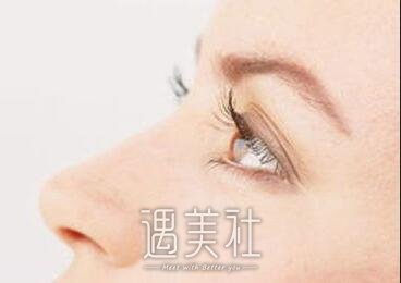 朝天鼻矫正
