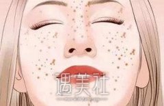 光子嫩肤能去雀斑，果怎么样喃？ width=