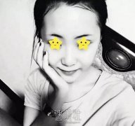 王珍祥做鼻子怎么样|王珍祥隆鼻案例硬核证明! width=