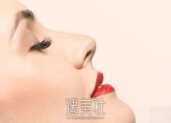 北京自体脂肪丰面颊要多少钱？和那些因素有关？ width=