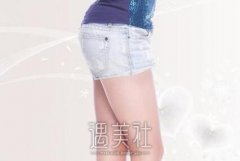 北京腿部吸脂手术要多少钱？和其他方式相比呢？ width=