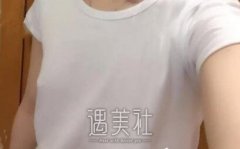 上海九院王涛假体丰胸案例：有胸的女人才更美！ width=