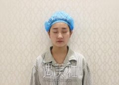 芜湖伊莱美整形价目表!你想要的假体隆鼻案例在这里~ width=