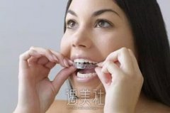 厦门成年牙齿矫正多少钱，什么决定了价格~ width=