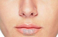 上海鼻头缩小收费贵不贵，几千块能搞定不？ width=