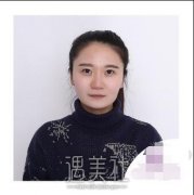 上海时光整形医院价目表|何晋龙下颌角156天对比案例~ width=