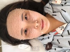 穆宝安的面部提升技术怎样?有真实案例吗? width=