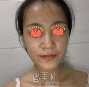 武汉亚太程晓林案例：程医生的技术值得信赖！ width=
