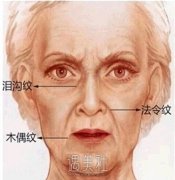 上海九院去法令纹价格大概多少?比私立机构贵吗? width=