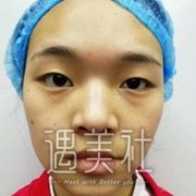 八大处杨明勇案例图片：杨医生技术果然很六! width=