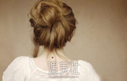 激光点痦子多久能洗脸?麻烦科普下~