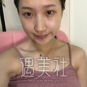 九院的濮哲铭鼻子做的怎么样?有隆鼻案例吗? width=