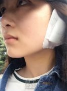 西安交大附属二院整形科价格表|耳软骨隆鼻后气质都不一样~ width=