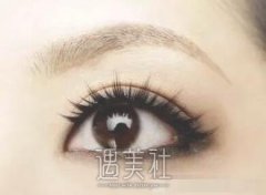割双眼皮出现“香肠眼”怎么办?如何避免? width=