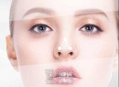 上海做鼻头缩小多少钱?比其它城市贵吗？ width=
